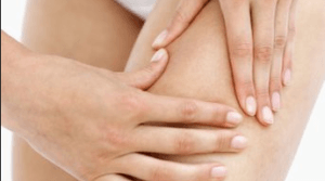 Уплотнение на внутренней стороне бедра у женщин: фото, причины, лечение