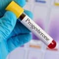 Избыток прогестерона у женщин: симптомы