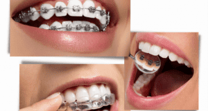 Ортодонтия в XXI веке: инновационные подходы к прямой улыбке